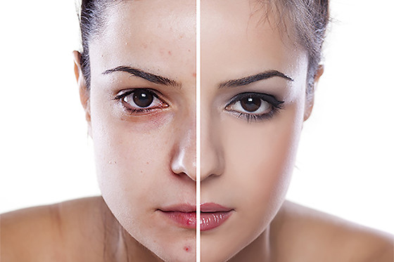 Dans la Box - photo 4